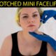 Botched Mini Facelift