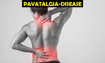 pavatalgia-disease