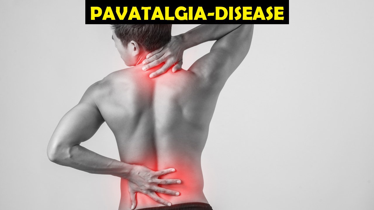 pavatalgia-disease
