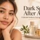 Dark Spots After Acne